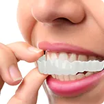 Snap On Smile #3