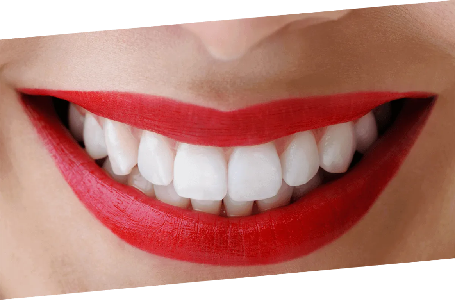 Snap On Smile #1